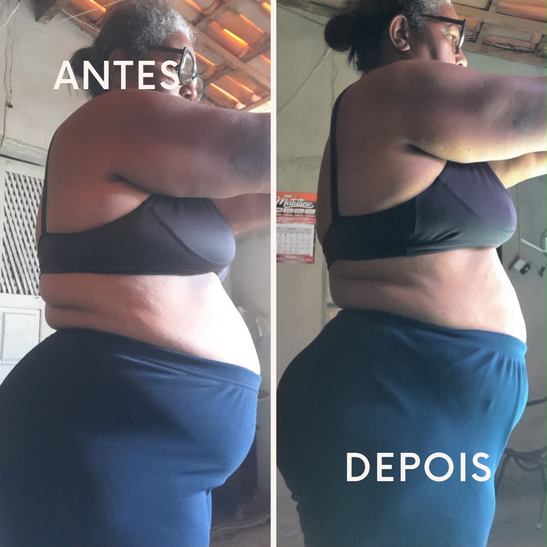 Antes e depois 3