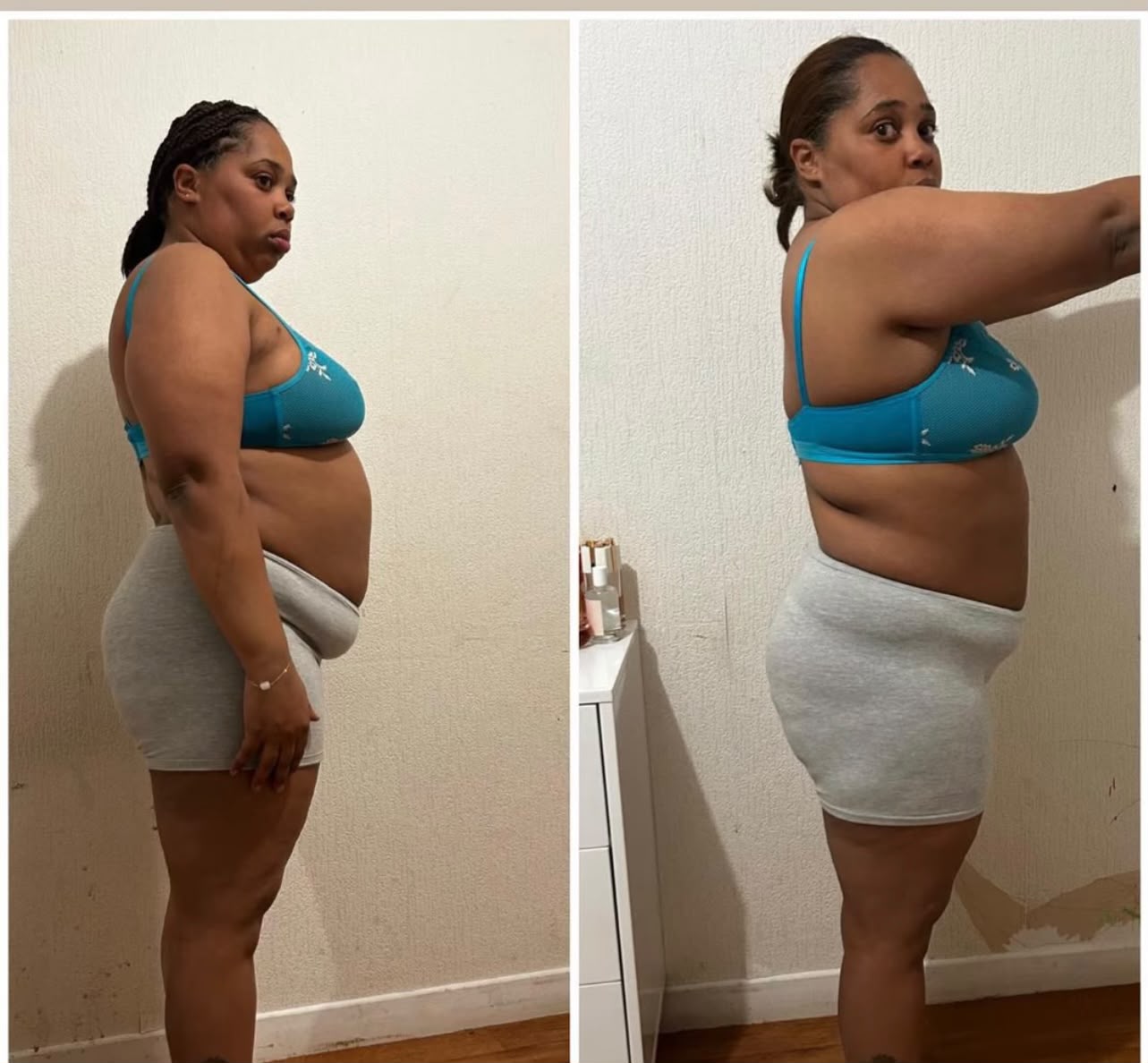 Antes e depois 4