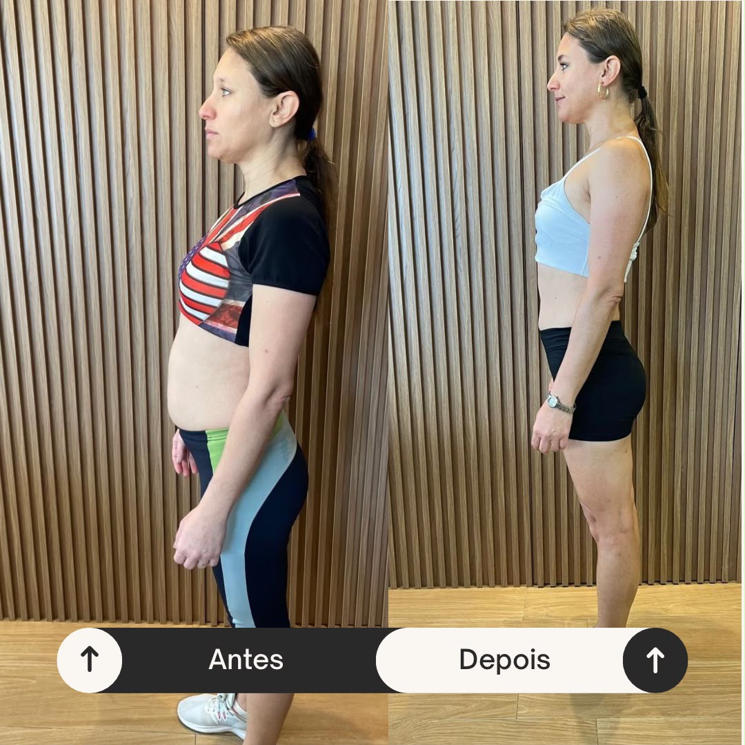 Antes e depois 6