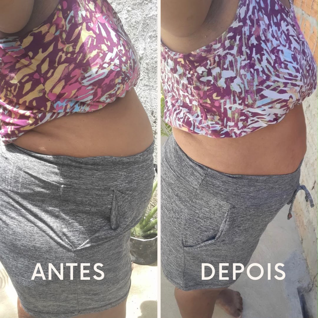 Antes e depois 2